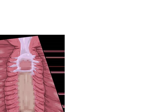 ev_kobura_ct03
