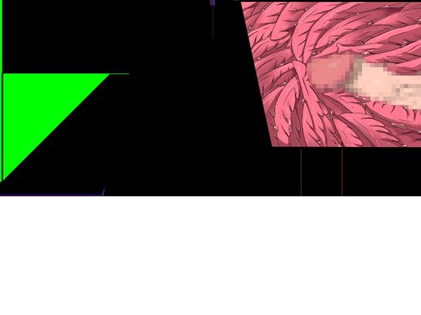 ev_mdg_ct31