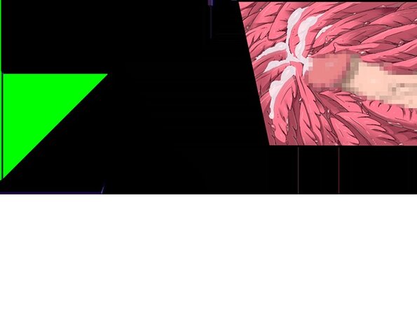 ev_mdg_ct32
