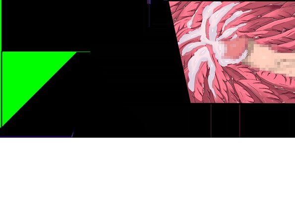 ev_mdg_ct33