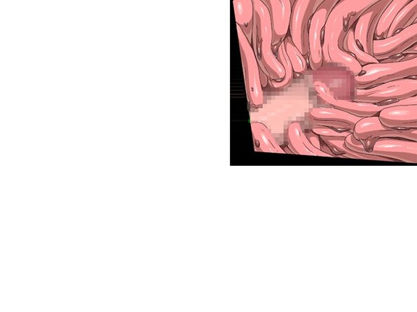 ev_meda_ct01