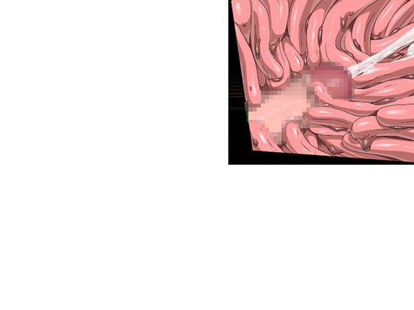ev_meda_ct02
