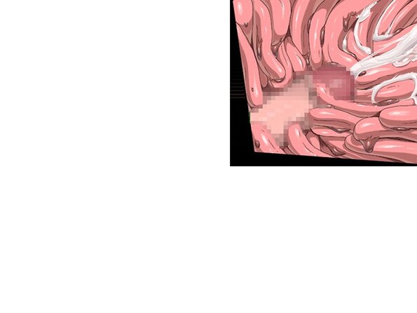 ev_meda_ct03