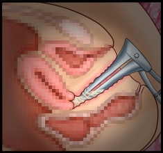 CG10a_02