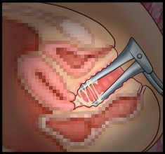 CG10a_03