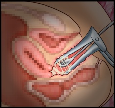 CG10a_04