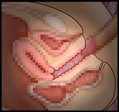 CG10a_08b